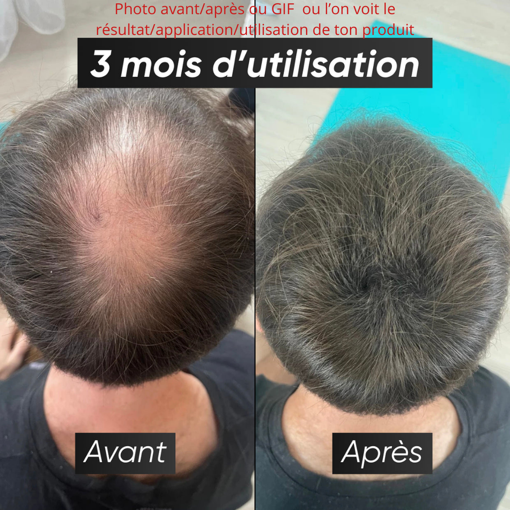 Marque - Bénéfice court et clair qu'apporte ton produit