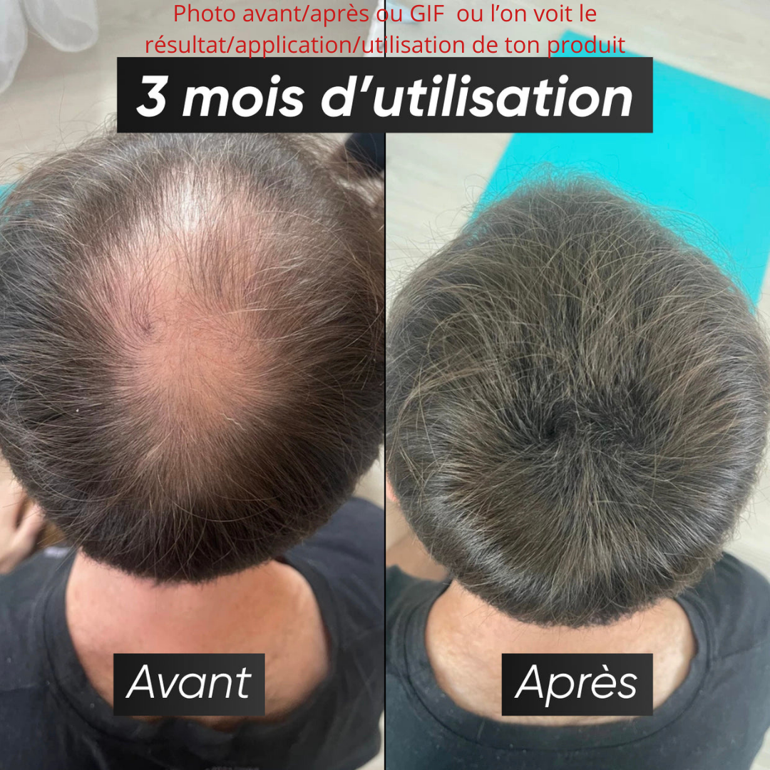 Marque - Bénéfice court et clair qu'apporte ton produit